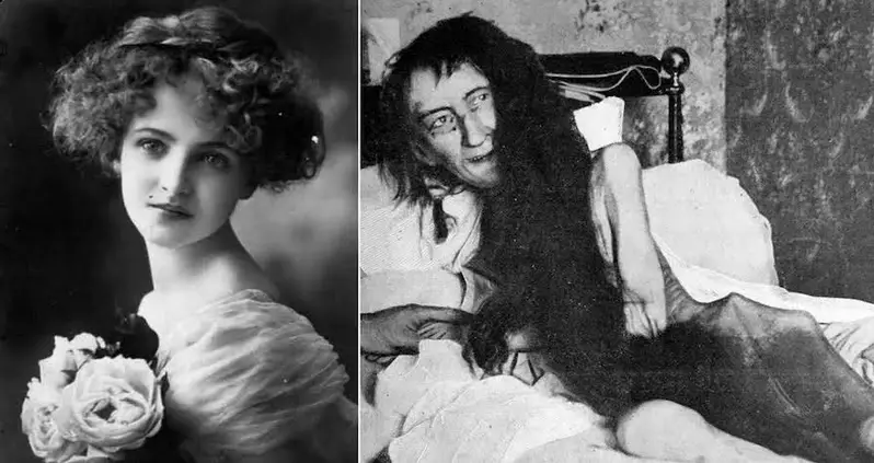 Blanche Monnier Was Kept Hidden In Her Room For 25 Years, Just For Falling In Love