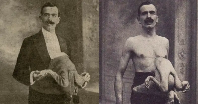 The Life Of Circus Performer Jean Libbera, The Man With A Parasitic Twin Growing Out Of His Torso