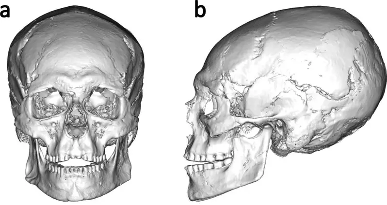 12,500-Year-Old Skull Unearthed In An Italian Cave Is The Oldest Cranial Modification Ever Found In Europe