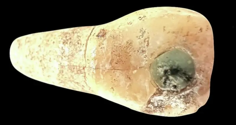 Jade Dental Inlays Were Just Discovered In The Teeth Of Maya Children