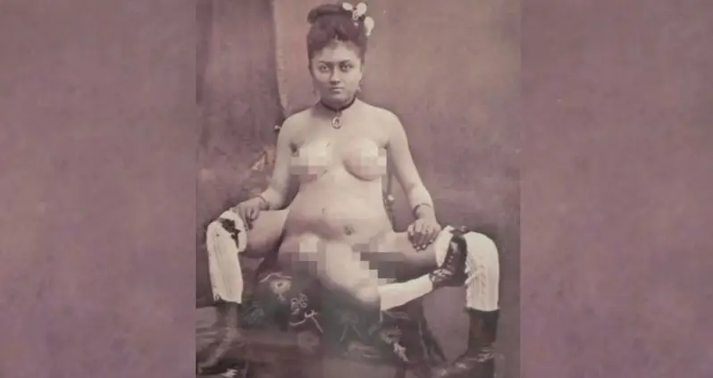 Blanche Dumas, The ‘Three-Legged Courtesan’ Who Had Four Breasts And Two Vaginas