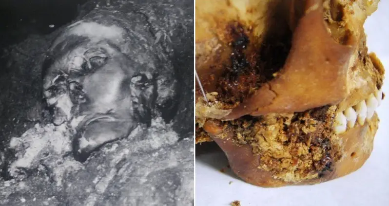Archaeologists Have Uncovered A Siberian Ice Mummy Who Underwent Jaw Surgery 2,500 Years Ago