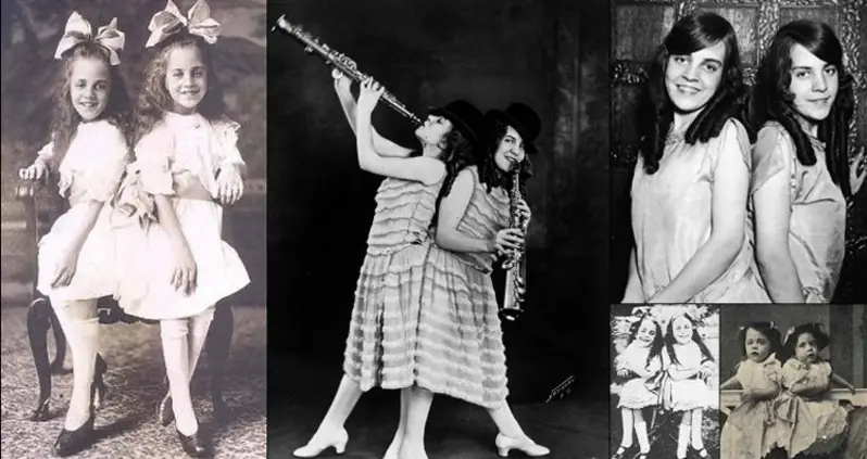 The Curious Life Of The Conjoined Hilton Sisters