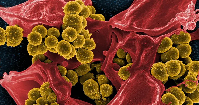 What You Need To Know About “Superbugs”