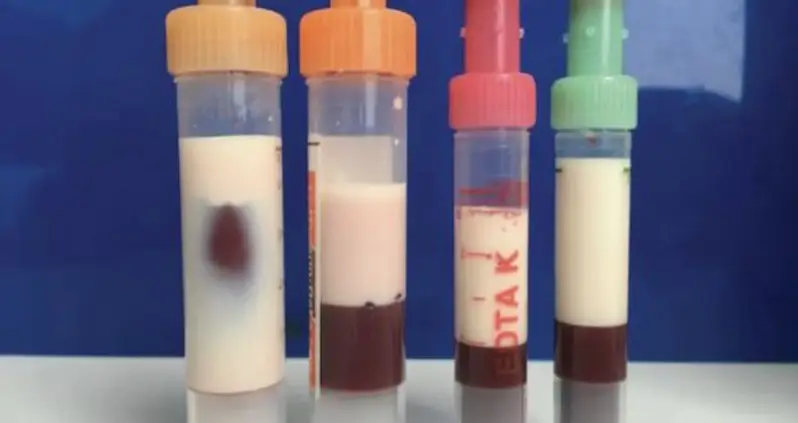 German Man’s Blood Was So Fatty It Turned Thick, White, And Milky