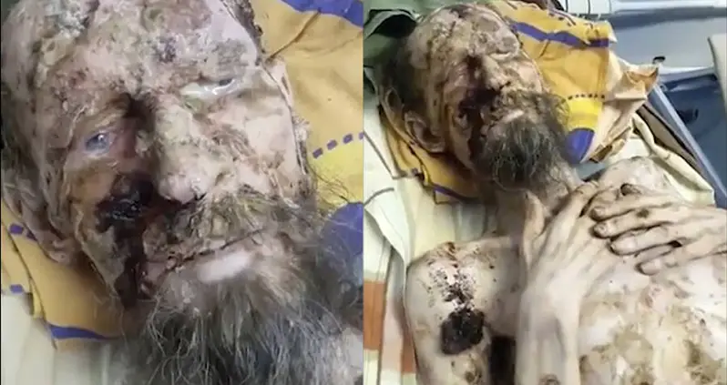 Man Mauled And ‘Preserved As Food’ By Bear Survives A Month In Its Den