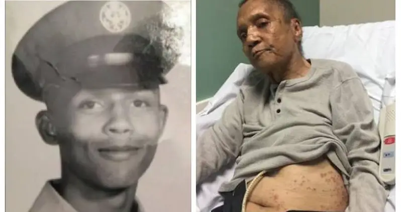Air Force Veteran Dies Covered In Ant Bites At Veterans Affairs Hospital In Georgia