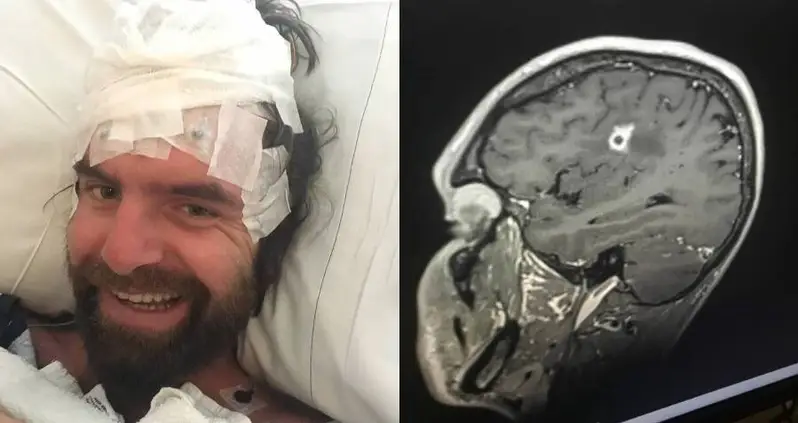 Doctors Discover Rare ‘Black Mold’ Growing In Rhode Island Man’s Brain