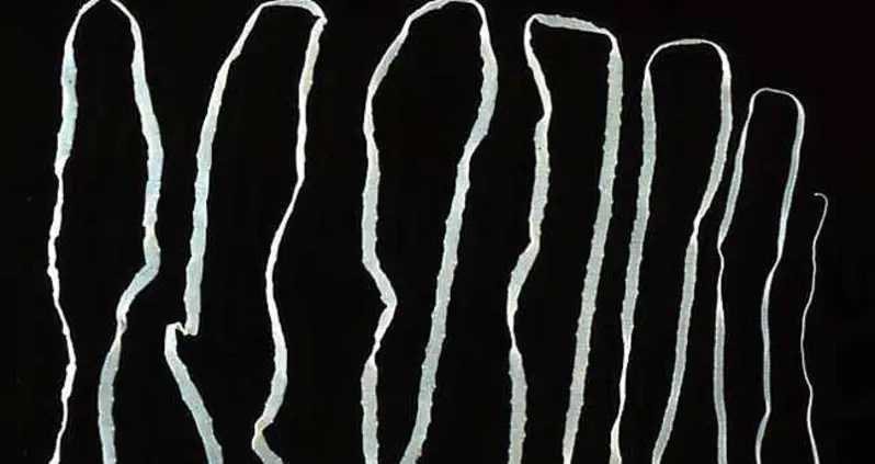 Seven Of The Dumbest Diet Trends In History