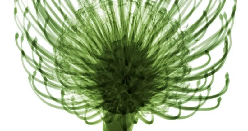 Bryan Whitney’s Incredible X-Ray Art