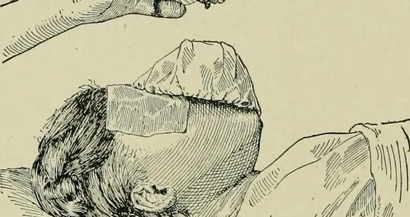 The Complicated Birth Of Midwifery
