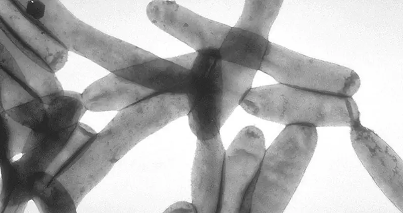 What Is Legionnaires’ Disease?