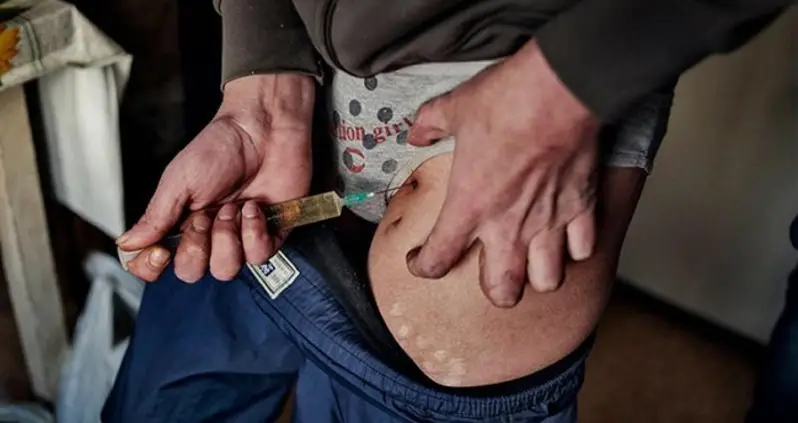 What Happens To Your Body When You Do Krokodil, The “Zombie Drug”