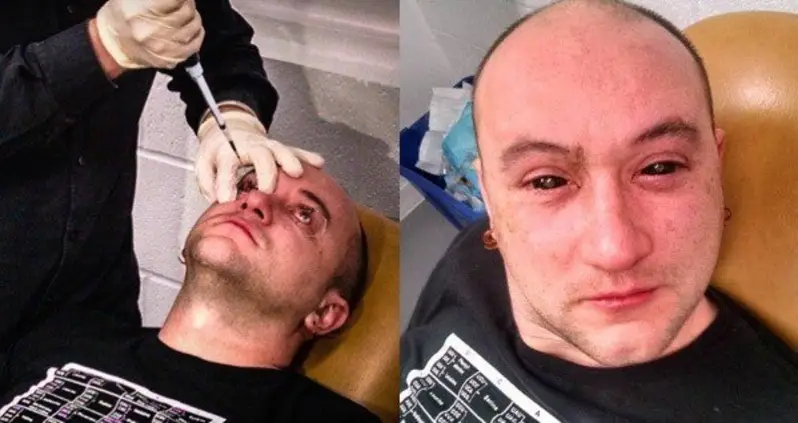 Biohacking: How DIY Scientists Are Upgrading Their Bodies To Gain Superhuman Abilities