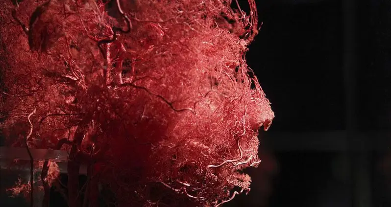 5 Unusual Disorders That Seem Too Strange To Be Real