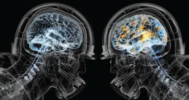 “Impossible to Ignore” Study Shows Strongest Link Ever Between Playing Football And CTE