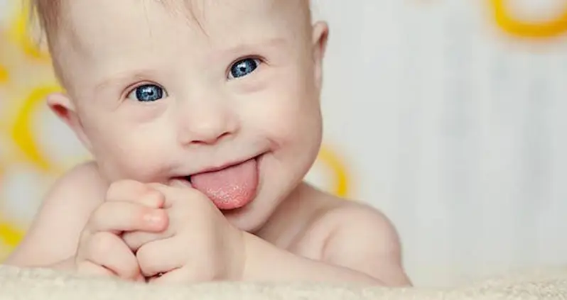 Down Syndrome Almost Eradicated In Iceland Thanks To Controversial Prenatal Screenings