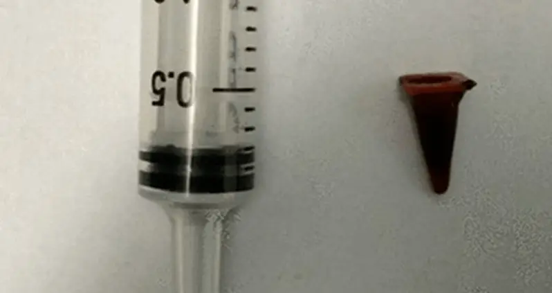Man’s Tumor Turns Out To Be A Playmobil Traffic Cone