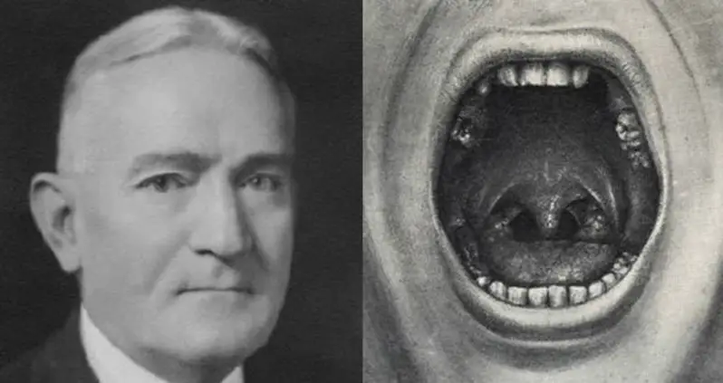 The Horrifying “Cures” Of Dr. Henry Cotton — America’s Biggest Quack