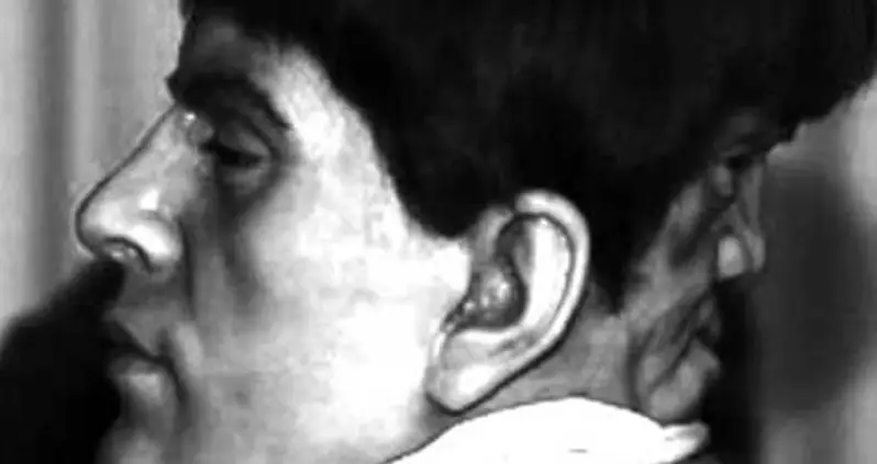 Edward Mordrake, The Man Who Allegedly Had One Head And Two Faces