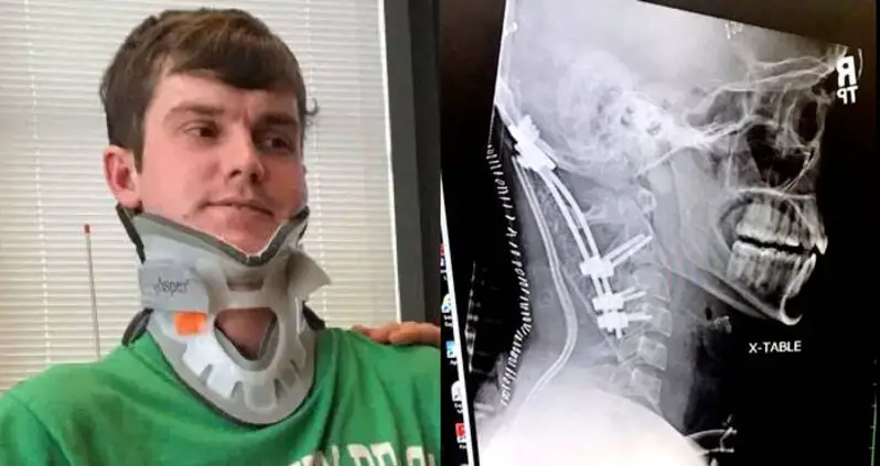 Internal Decapitation: What It Is And How One Man Survived