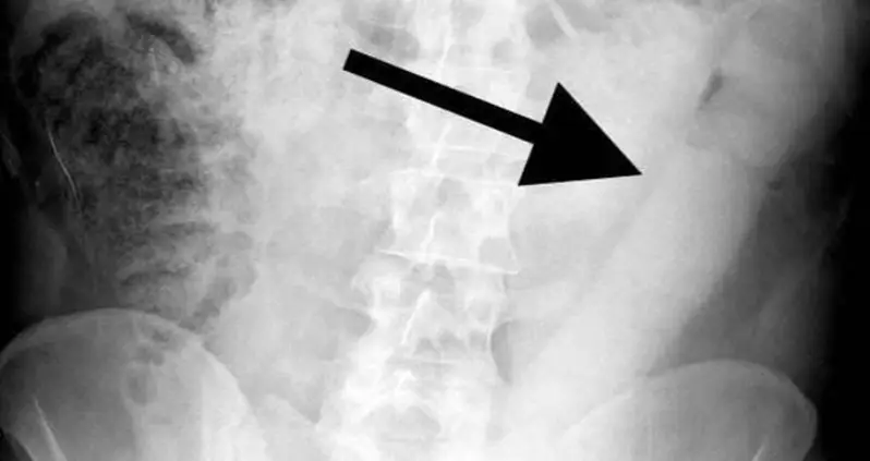 Insane, Unsound, And Just Plain Stupid: The 2018 Darwin Awards