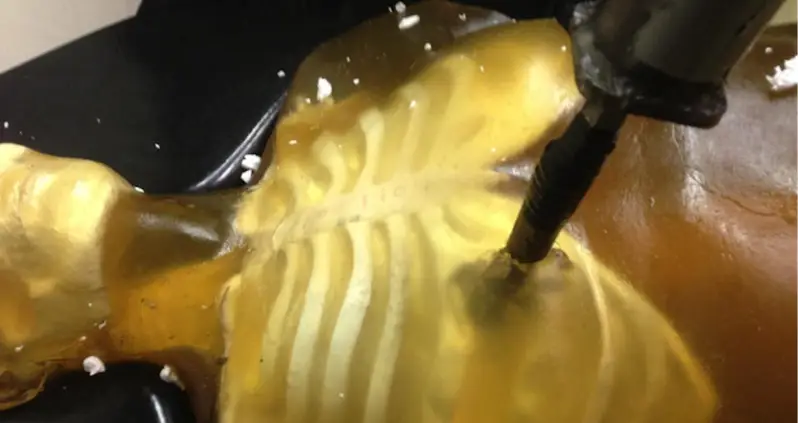 Strange Hole In Ancient Greek Skeleton’s Chest Allows Researchers To Solve Murder Mystery