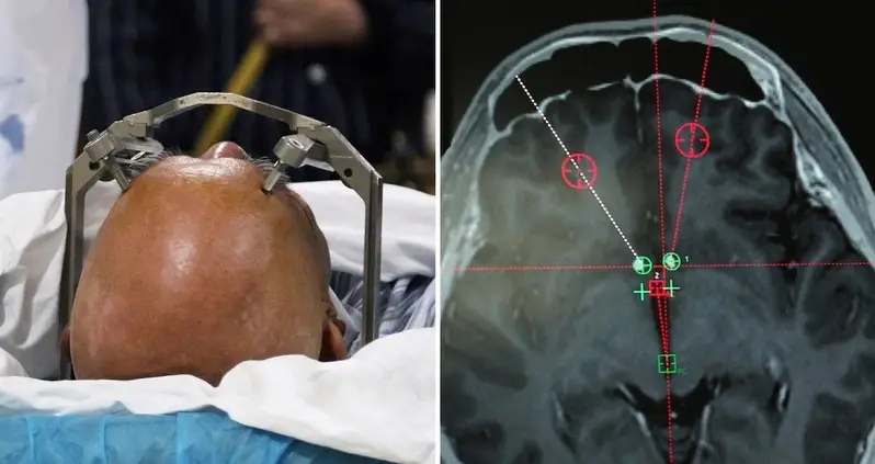 China Is Using Brain Implants To Treat Addiction In A World-First