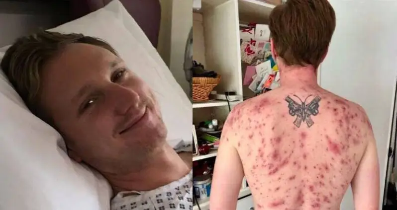 Parasitic Worm Crawls Up Man’s Penis, Lays Eggs, And Then Nearly Kills Him