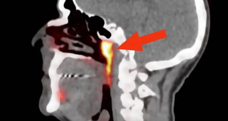 Cancer Researchers Accidentally Find Secret Organ Hidden Inside The Human Head