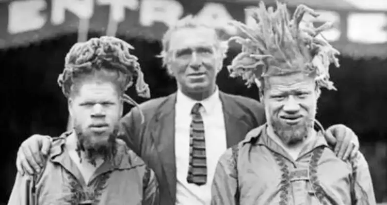 George And Willie Muse, The Black Brothers Who Were Kidnapped By The Circus And Billed As ‘Martians’