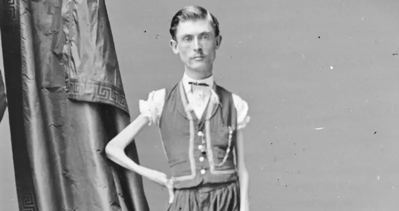Isaac Sprague Found Sideshow Fame As The ‘Living Skeleton’ — But His Offstage Story Was Tragic