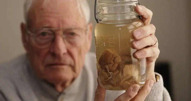 Inside The Bizarre Story Of Albert Einstein’s Brain — After It Was Stolen From His Body