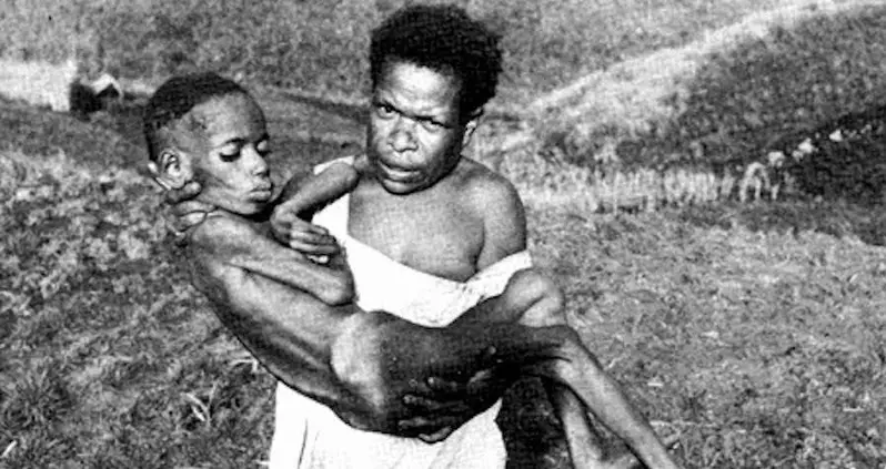 The Disturbing History Of Kuru, The Fatal Brain Disease Caused By Cannibalism