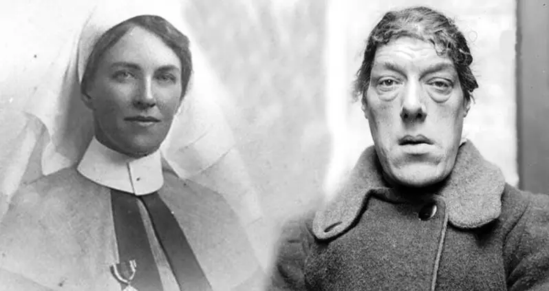 The Tragic Story Of Mary Ann Bevan, The ‘Ugliest Woman In The World’