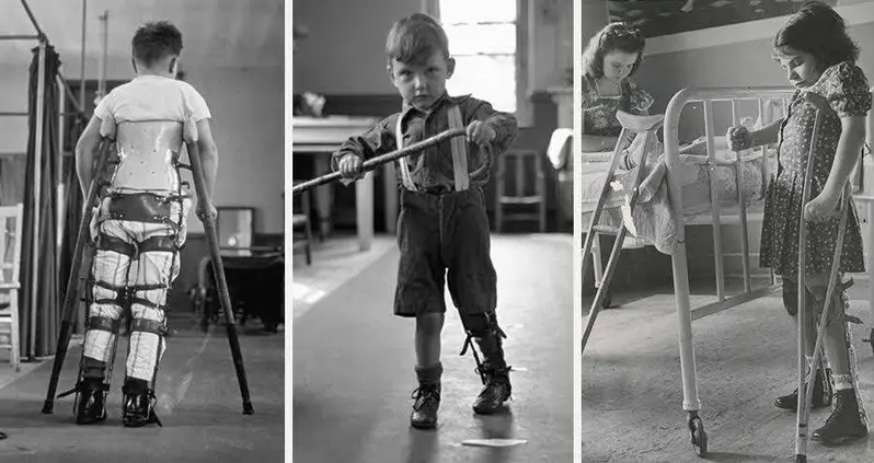 44 Grim Photos That Show The Brutal Reality Of Mid-Century America’s Polio Epidemics