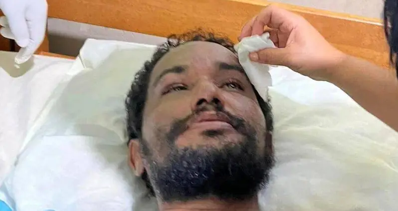 Bolivian Man Survives In The Amazon Rainforest For A Month By Eating Worms And Drinking His Own Urine