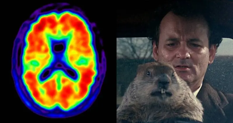Man With Alzheimer’s Disease Experiences Rare Symptom That Makes Him Feel Like He’s Living In ‘Groundhog Day’