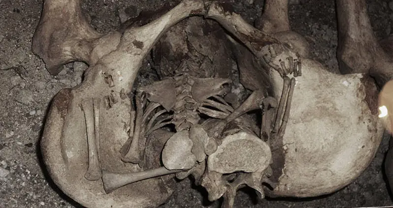 What Is A Coffin Birth — And What Causes This Horrifying Phenomenon?