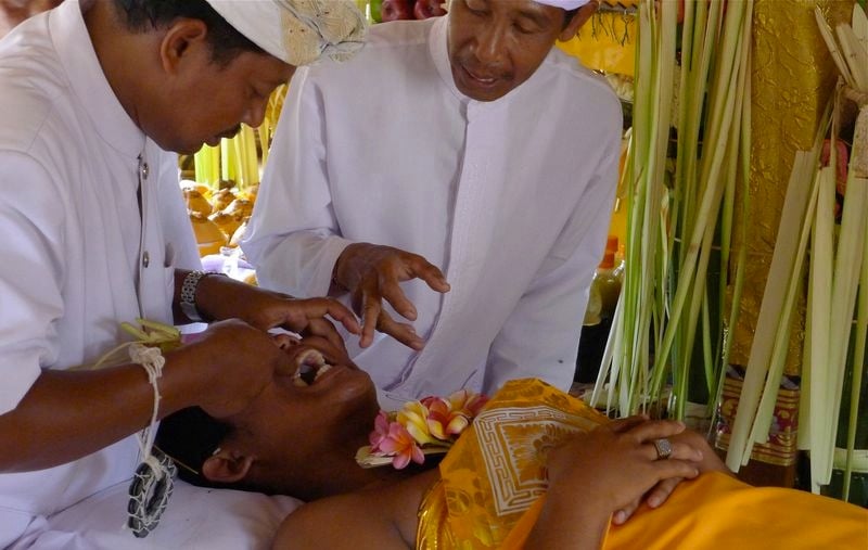 Unusual Rites Of Passage Bali Teeth Filing