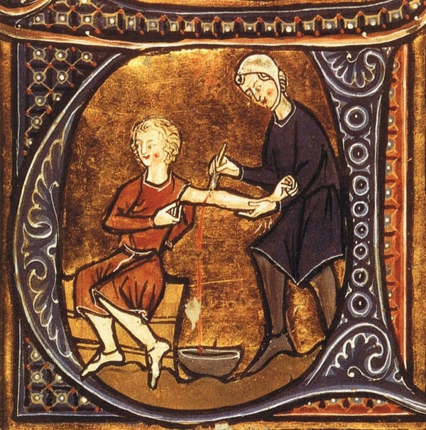 Painful Medical Procedures Of Medieval Era Bloodletting