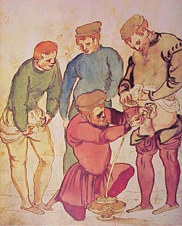 Painful Medical Procedures Of Medieval Times Catheter