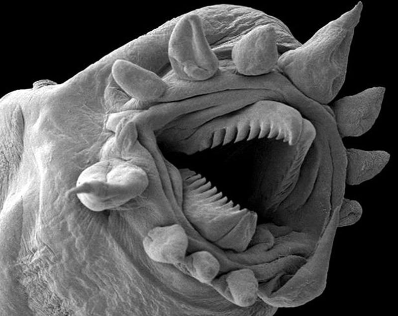 Scary Microscopic Bug