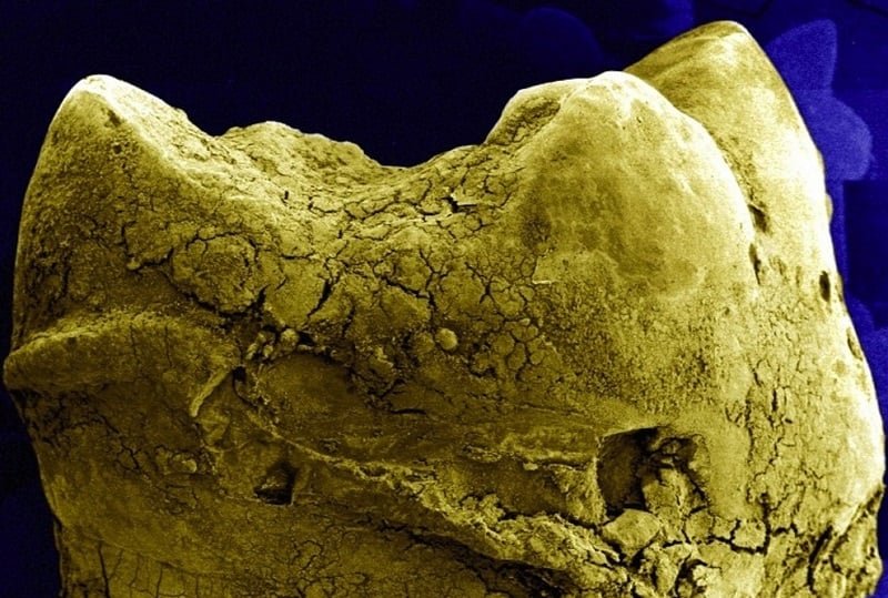 Tooth Under Microscope
