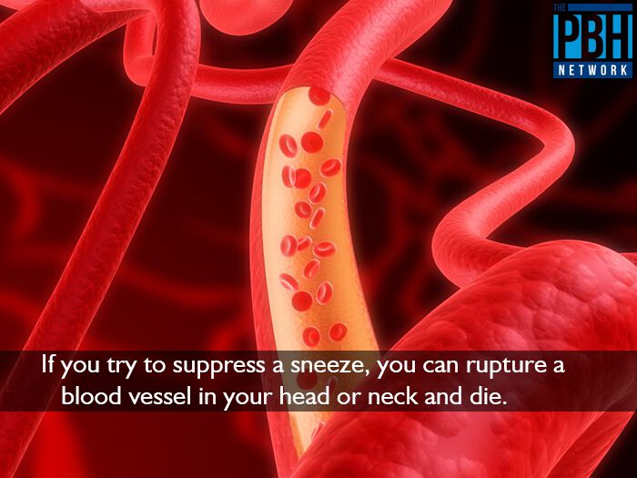 Suppressing Sneezes