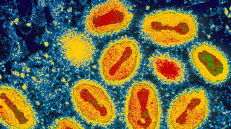 Worst Ways To Die Smallpox Virus