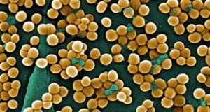 Scary Diseases Mrsa Microscope