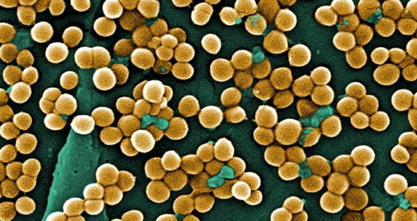 Scary Diseases Mrsa Microscope