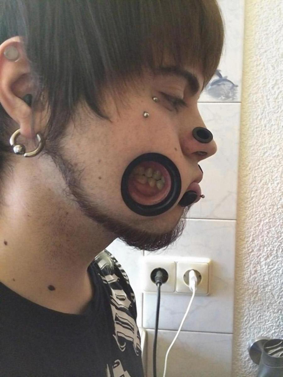 Extreme Body Modification Exposed Teeth