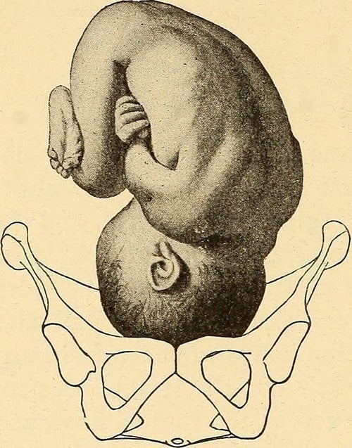 Midwife History Pelvis